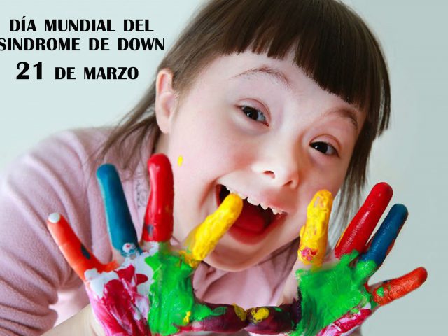 Sindrome de Down Sindrome de Down